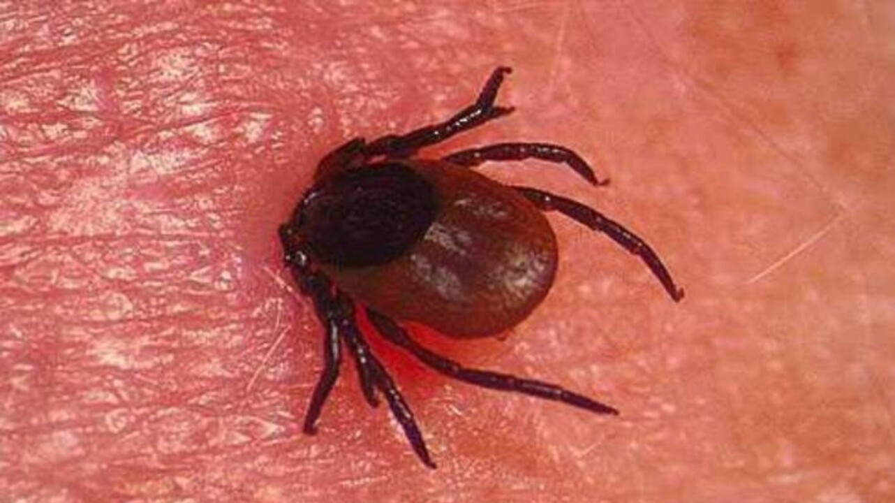 Kene ısırığı organ yetmezliğine sürüklüyor