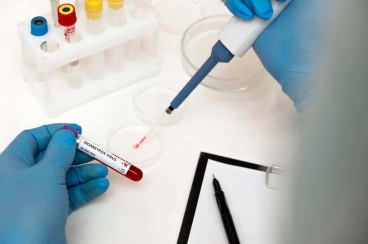 Mayısmun çiçeği cinsel yolla bulaşabiliyor