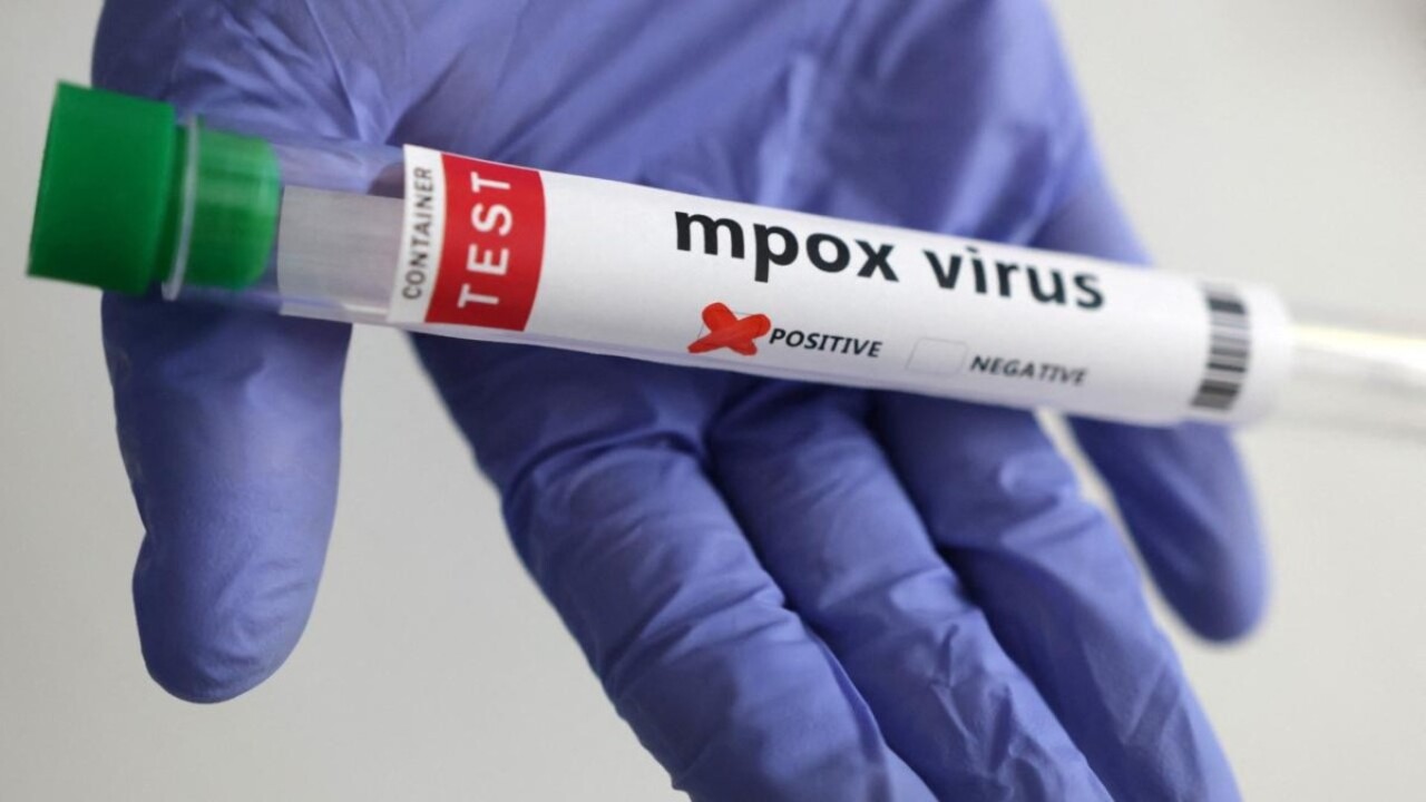 virüs